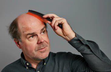 Imagen sobre el servicio de Protesis capilar